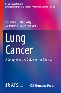 Abbildung von Rivera / Macrosty | Lung Cancer | 1. Auflage | 2024 | beck-shop.de