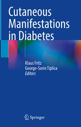 Abbildung von Fritz / Tiplica | Cutaneous Manifestations in Diabetes | 1. Auflage | 2024 | beck-shop.de