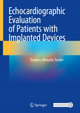 Abbildung von Toader | Echocardiographic Evaluation of Patients with Implanted Devices | 1. Auflage | 2024 | beck-shop.de