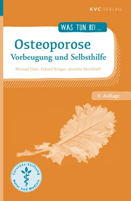 Abbildung von Elies / Krüger | Osteoporose | 3. Auflage | 2024 | beck-shop.de