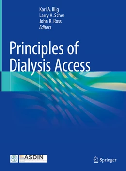 Abbildung von Illig / Scher | Principles of Dialysis Access | 1. Auflage | 2024 | beck-shop.de