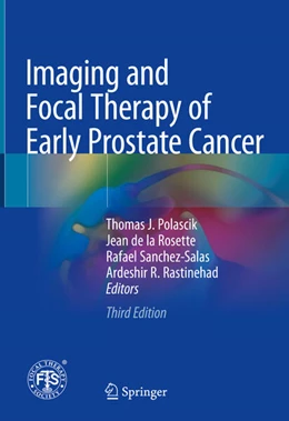 Abbildung von Polascik / De La Rosette | Imaging and Focal Therapy of Early Prostate Cancer | 3. Auflage | 2024 | beck-shop.de