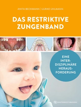 Abbildung von Beckmann / Uhlmann | Das restriktive Zungenband | 1. Auflage | 2024 | beck-shop.de