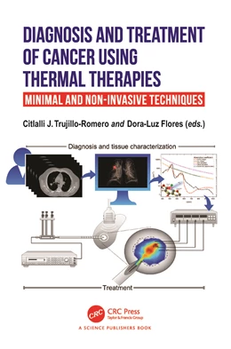 Abbildung von J. Trujillo Romero / Flores | Diagnosis and Treatment of Cancer using Thermal Therapies | 1. Auflage | 2025 | beck-shop.de