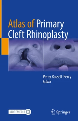 Abbildung von Rossell-Perry | Atlas of Primary Cleft Rhinoplasty | 1. Auflage | 2024 | beck-shop.de