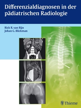 Abbildung von Differenzialdiagnosen in der pädiatrischen Radiologie | 1. Auflage | 2012 | beck-shop.de