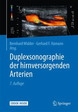 Abbildung von Widder / Hamann | Duplexsonographie der hirnversorgenden Arterien | 7. Auflage | 2018 | beck-shop.de