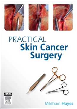 Abbildung von Hayes | Practical Skin Cancer Surgery | 1. Auflage | 2014 | beck-shop.de