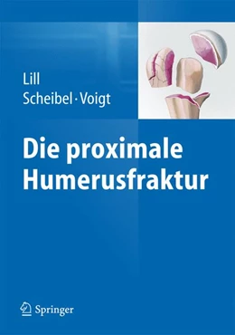 Abbildung von Lill / Scheibel | Die proximale Humerusfraktur | 1. Auflage | 2014 | beck-shop.de