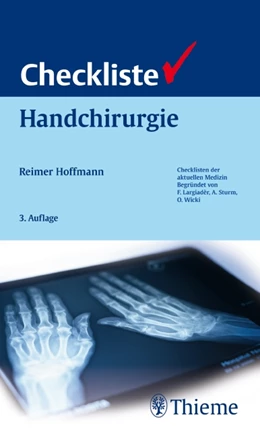 Abbildung von Hoffmann | Checkliste Handchirurgie | 1. Auflage | 2009 | beck-shop.de