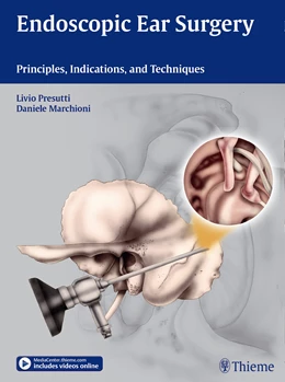 Abbildung von Marchioni / Presutti | Endoscopic Ear Surgery | 1. Auflage | 2014 | beck-shop.de