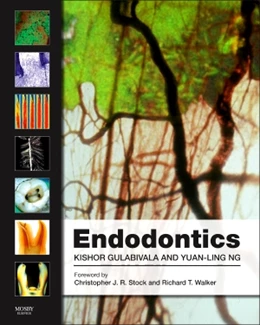 Abbildung von Gulabivala / Ng | Endodontics | 4. Auflage | 2014 | beck-shop.de