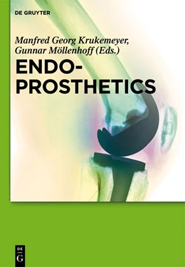 Abbildung von Krukemeyer / Möllenhoff | Endoprosthetics | 1. Auflage | 2014 | beck-shop.de
