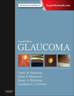 Abbildung von Shaarawy / Sherwood | Glaucoma | 2. Auflage | 2014 | beck-shop.de