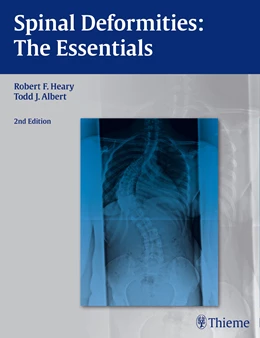 Abbildung von Heary / Albert | Spinal Deformities | 2. Auflage | 2014 | beck-shop.de