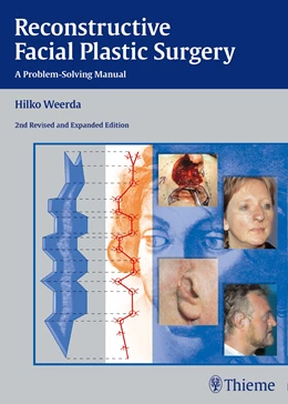 Abbildung von Weerda | Reconstructive Facial Plastic Surgery | 2. Auflage | 2014 | beck-shop.de