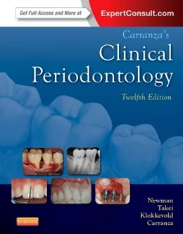 Abbildung von Newman / Takei | Carranza's Clinical Periodontology | 12. Auflage | 2014 | beck-shop.de