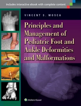 Abbildung von Mosca | Foot and Deformities and Malformations in Children: A Principles-Based, Practical Guide to Assessment and Management | 1. Auflage | 2014 | beck-shop.de