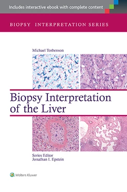 Abbildung von Torbenson | Biopsy Interpretation of the Liver | 3. Auflage | 2014 | beck-shop.de