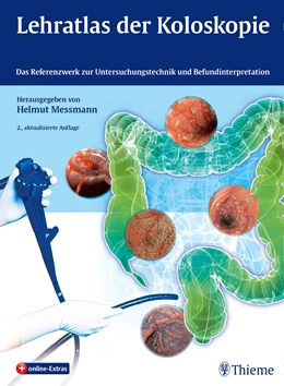 Abbildung von Messmann | Lehratlas der Koloskopie | 2. Auflage | 2014 | beck-shop.de