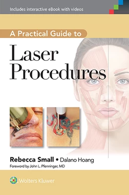 Abbildung von Small | A Practical Guide to Laser Procedures | 1. Auflage | 2015 | beck-shop.de