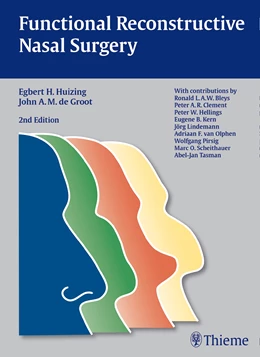 Abbildung von de Groot / Huizing | Functional Reconstructive Nasal Surgery | 2. Auflage | 2015 | beck-shop.de