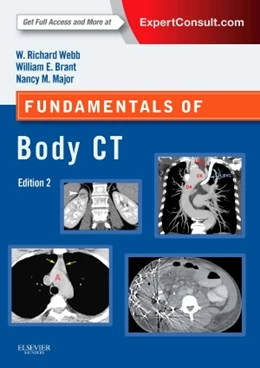 Abbildung von Webb / Brant | Fundamentals of Body CT | 4. Auflage | 2014 | beck-shop.de