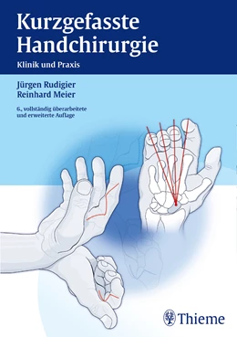 Abbildung von Rudigier / Meier | Kurzgefasste Handchirurgie | 6. Auflage | 2014 | beck-shop.de
