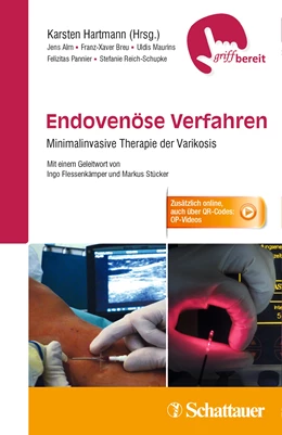 Abbildung von Hartmann | Endovenöse Verfahren | 1. Auflage | 2015 | beck-shop.de