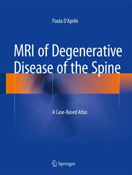 Abbildung von D'Aprile | MRI of Degenerative Disease of the Spine | 1. Auflage | 2014 | beck-shop.de