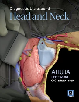 Abbildung von Ahuja | Diagnostic Ultrasound: Head and Neck | 1. Auflage | 2014 | beck-shop.de