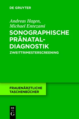 Abbildung von Hagen / Entezami | Sonographische Pränataldiagnostik | 1. Auflage | 2014 | beck-shop.de