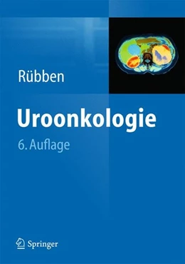 Abbildung von Rübben | Uroonkologie | 6. Auflage | 2014 | beck-shop.de
