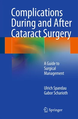 Abbildung von Spandau / Scharioth | Complications During and After Cataract Surgery | 1. Auflage | 2014 | beck-shop.de