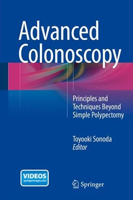 Abbildung von Sonoda | Advanced Colonoscopy | 1. Auflage | | beck-shop.de