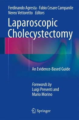 Abbildung von Agresta / Campanile | Laparoscopic Cholecystectomy | 1. Auflage | 2014 | beck-shop.de