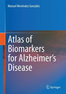 Abbildung von Menéndez González | Atlas of Biomarkers for Alzheimer's Disease | 1. Auflage | 2014 | beck-shop.de