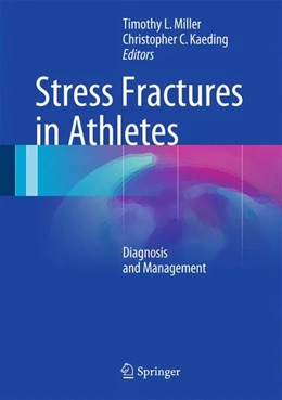 Abbildung von Miller / Kaeding | Stress Fractures in Athletes | 1. Auflage | 2014 | beck-shop.de