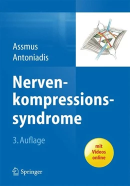 Abbildung von Assmus / Antoniadis | Nervenkompressionssyndrome | 3. Auflage | 2014 | beck-shop.de