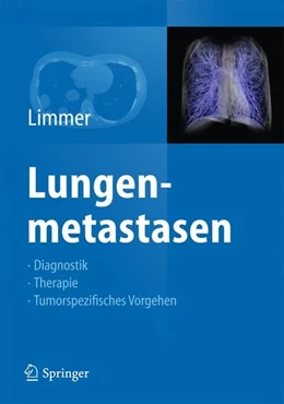 Abbildung von Limmer | Lungenmetastasen | 1. Auflage | 2014 | beck-shop.de