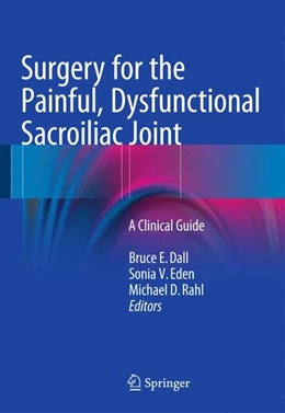Abbildung von Dall / Eden | Surgery for the Painful, Dysfunctional Sacroiliac Joint | 1. Auflage | 2014 | beck-shop.de