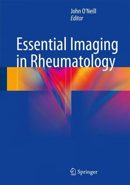 Abbildung von O'Neill | Essential Imaging in Rheumatology | 1. Auflage | | beck-shop.de
