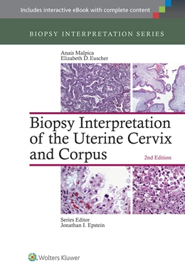 Abbildung von Malpica / Euscher | Biopsy Interpretation of the Uterine Cervix and Corpus | 2. Auflage | 2015 | beck-shop.de