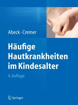 Abbildung von Abeck / Cremer | Häufige Hautkrankheiten im Kindesalter | 4. Auflage | 2014 | beck-shop.de