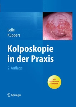Abbildung von Lellé / Küppers | Kolposkopie in der Praxis | 2. Auflage | 2014 | beck-shop.de