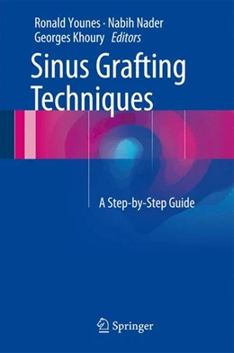Abbildung von Younes / Nader | Sinus Grafting Techniques | 1. Auflage | 2015 | beck-shop.de