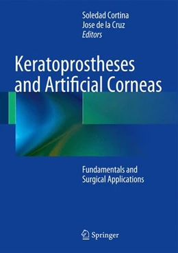 Abbildung von Cortina / de la Cruz | Keratoprostheses and Artificial Corneas | 1. Auflage | 2014 | beck-shop.de