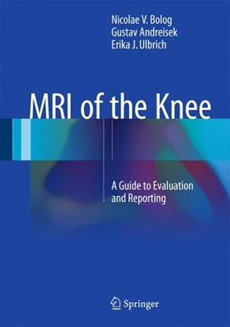 Abbildung von Bolog / Andreisek | MRI of the Knee | 1. Auflage | 2015 | beck-shop.de
