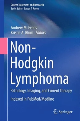 Abbildung von Evens / Blum | Non-Hodgkin Lymphoma | 1. Auflage | 2015 | beck-shop.de