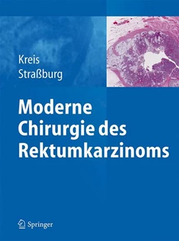 Abbildung von Kreis / Straßburg | Moderne Chirurgie des Rektumkarzinoms | 1. Auflage | 2015 | beck-shop.de